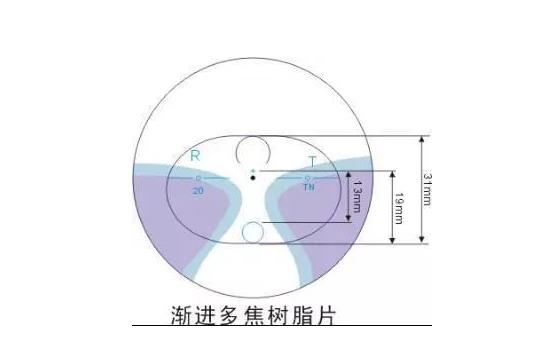美麗島多焦鏡適合的人群，需要注意的事項
